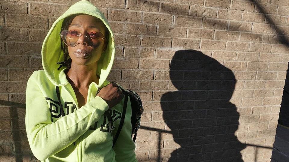 A Babysitter Scalded Her With Boiling Water — Now She Jokes About the Pain