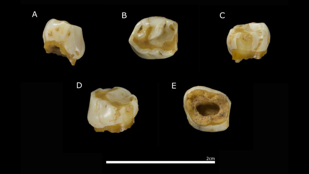 Tooth Hairy: Eight-year-old Cave Girl’s Milk Tooth Reveals The Secrets Of The Neanderthals