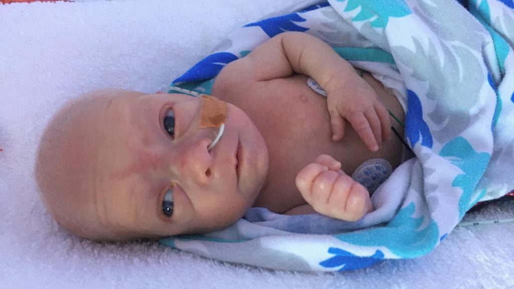 Paracetamol Promising For Premature Babies: Australian Study
