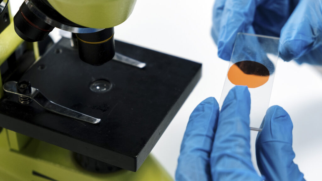Researchers Develop Novel AI Blood Testing Technology To Identify Lung Cancers