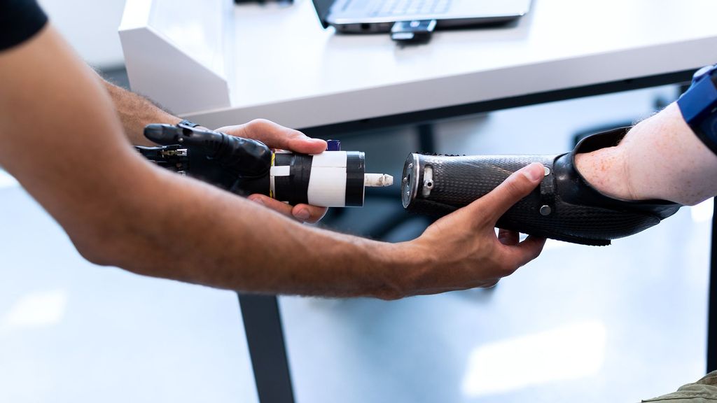 Magnets Could Offer Better Control Of Prosthetic Limbs: Study