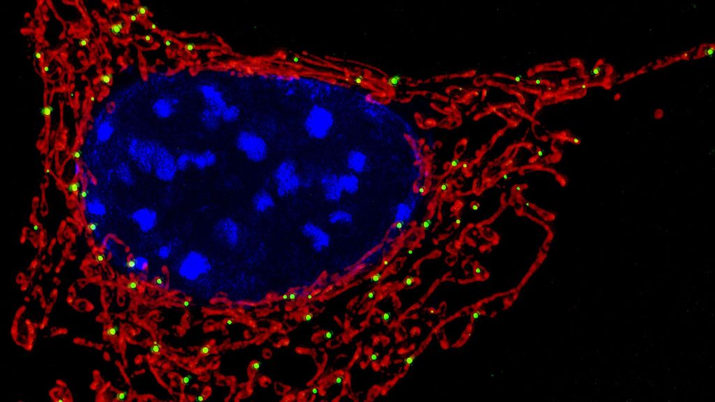 How A Parkinson’s Disease-linked Protein Attacks Mitochondria