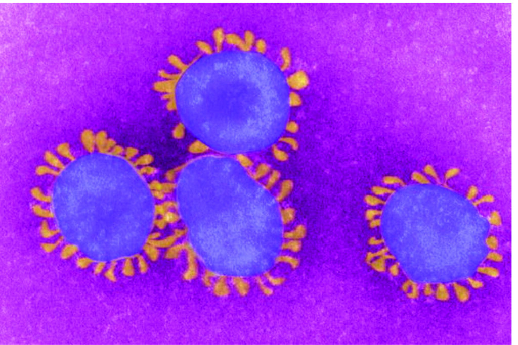 Medical Experts say COVID-19 Mu Variant is rare despite spread to 49 U.S. States