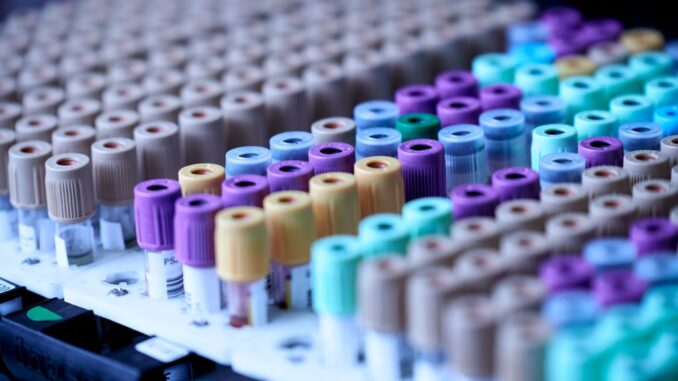 A whole-genome sequencing method, aided by artificial intelligence, enables early detection of persistent or recurrent cancer cells from a standard blood sample. (Testalize.me/Unsplash)